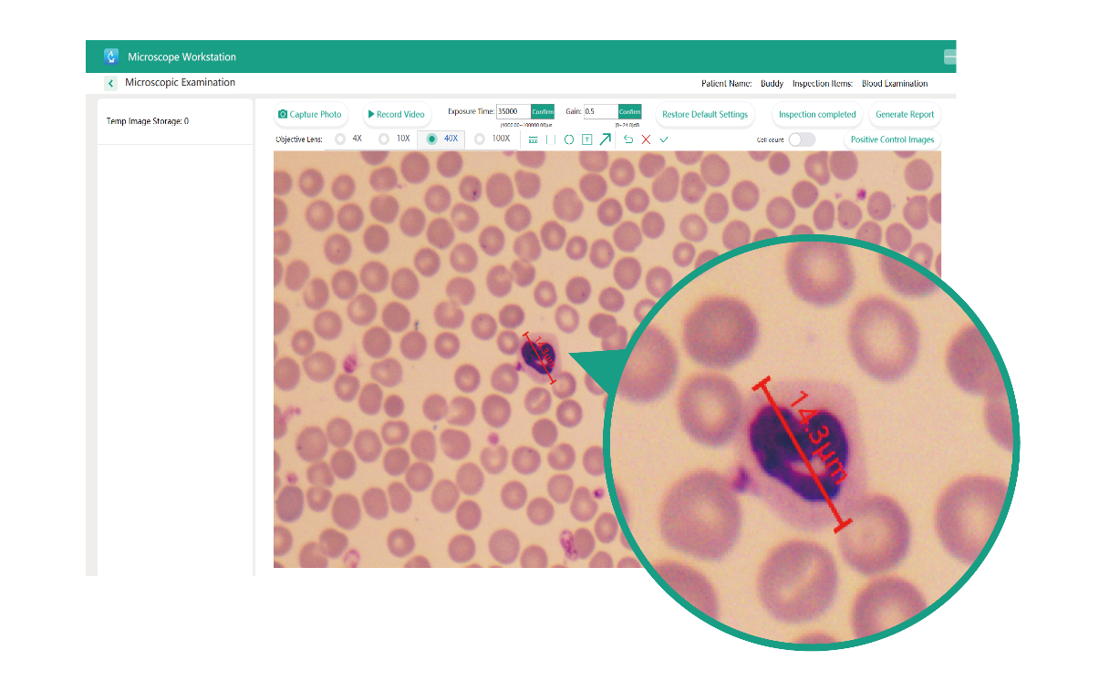 Awalife AI morphology report with on-screen cell measurement